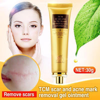 SmileWhite™ Acne & Scar Removal Cream