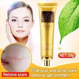 SmileWhite™ Acne & Scar Removal Cream